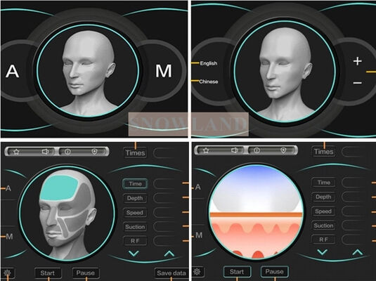 Cilt Temas Sensörlü Yüksek Hızlı Epilasyon Tedavisi Sağlayan Yarı İletken 808nm Lazer Diyot Lazer Epilasyon Makinesi