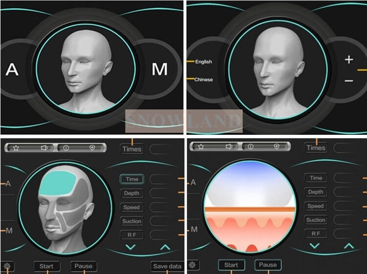 Cilt Temas Sensörlü Yüksek Hızlı Epilasyon Tedavisi Sağlayan Yarı İletken 808nm Lazer Diyot Lazer Epilasyon Makinesi